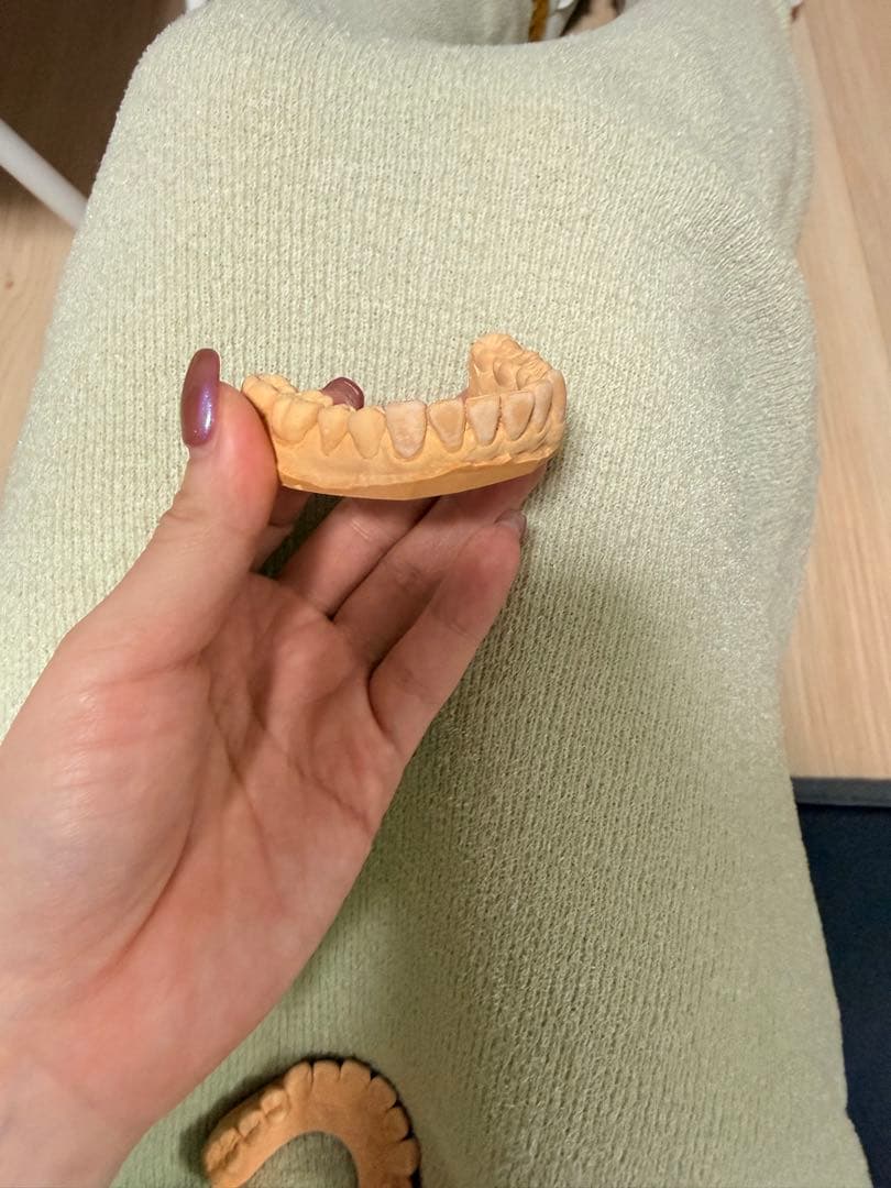 歯の模型 手のひらサイズ